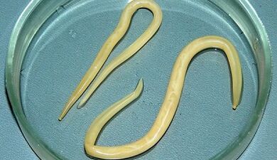 How to do Tests for ascariasis correctly