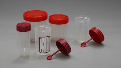 How to prepare for the parasitic test