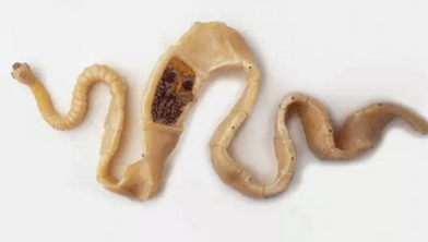 How to discover the presence of parasites in the body